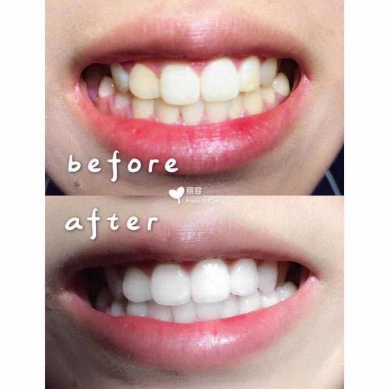 Lion King White & White Toothpaste 150g