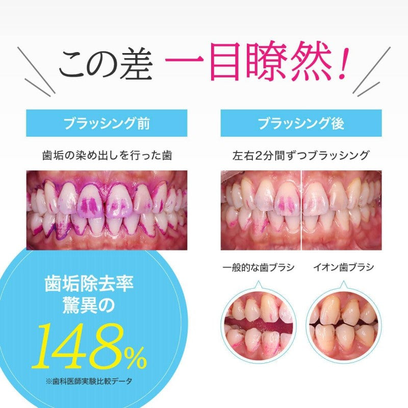 Kiss You Ion Soft Toothbrush Ultra Fine Random Color 1pcs