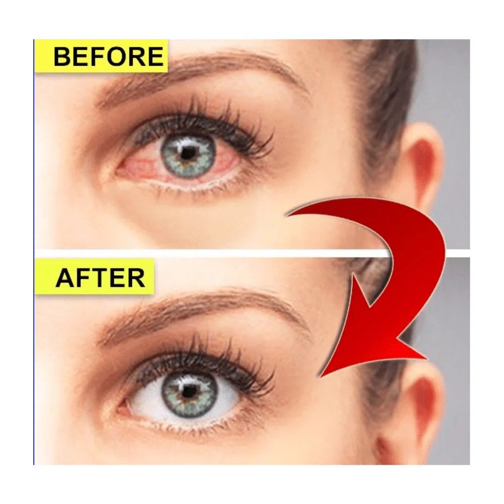 Rohto Eye Drops Vita 40α 12ml