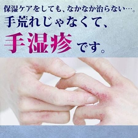 Rohto Mentholatum乐敦曼秀雷敦手部湿疹皮炎啫喱膏红色 8g