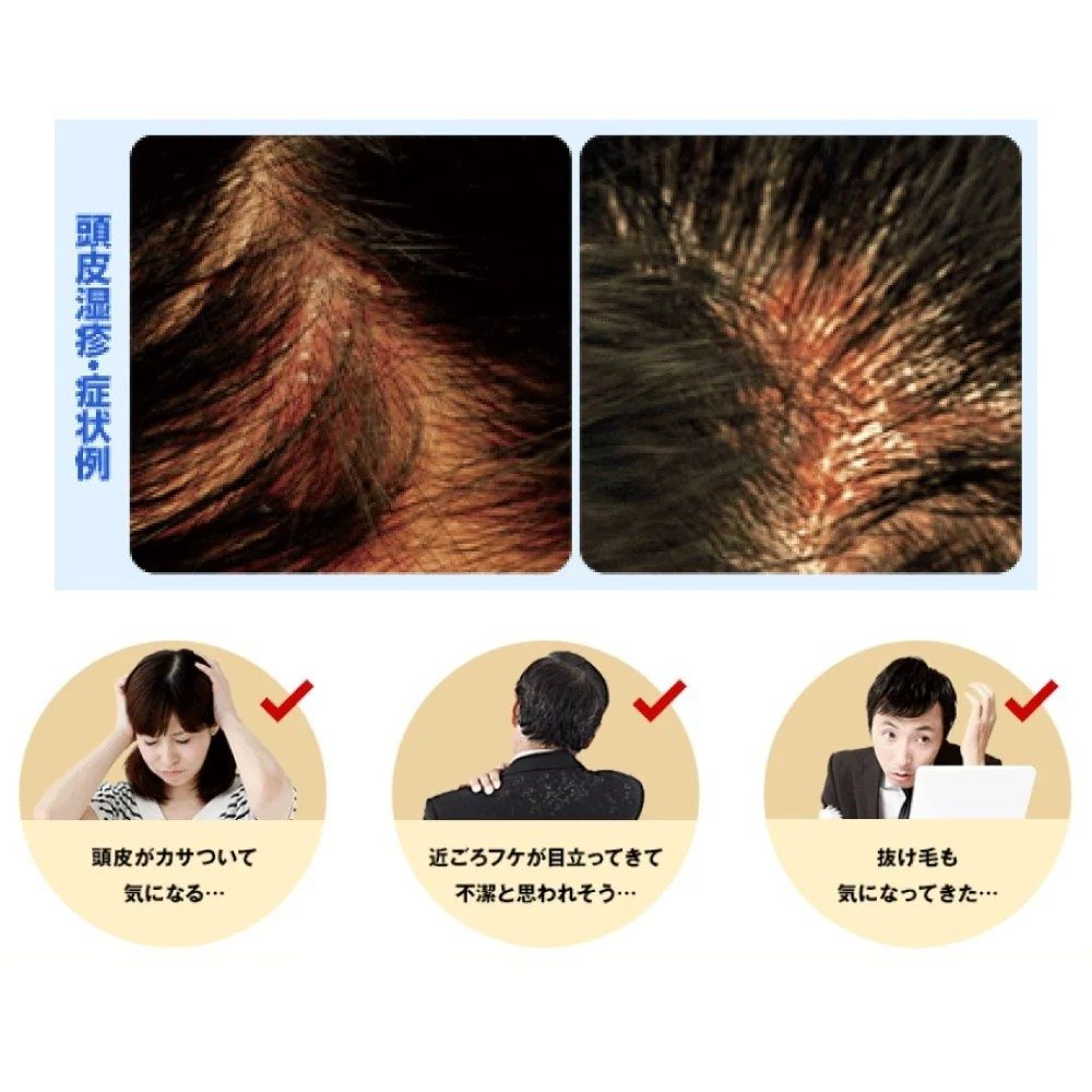 Rohto Mediquick H Scalp Medical Shampoo Against Itching & Dandruff 200ml