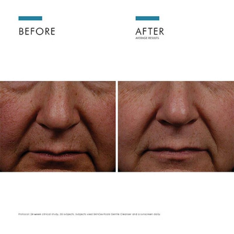 SkinCeuticals修丽可CE修护精华液抗氧化精华 30ml