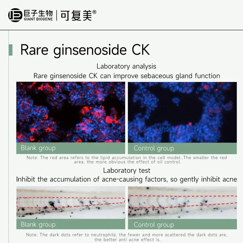 Kefumei Rare Ginsenoside Anti-acne Oil Control Essence Toner 150ml