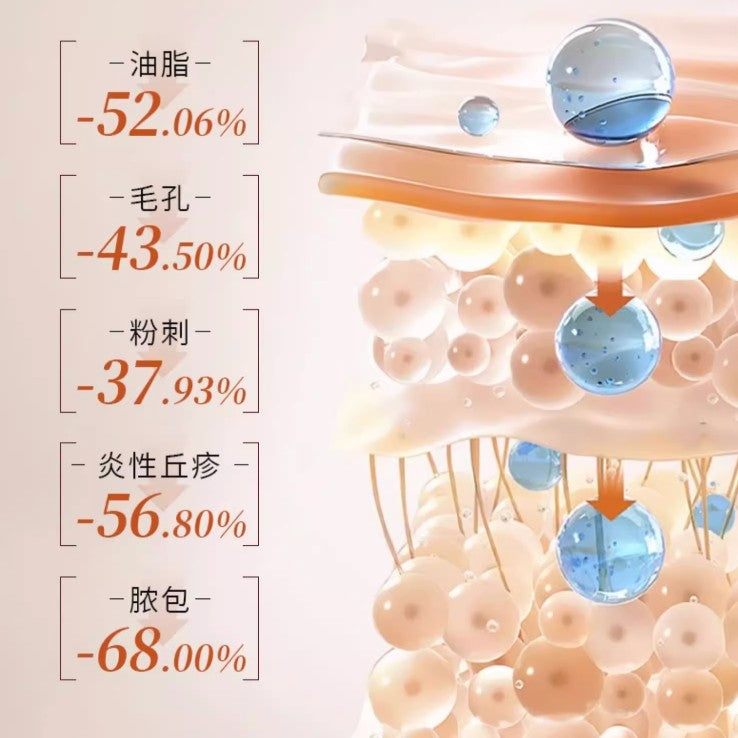 Voolga Lactic Acid Oil Control and Astringent Mask 5pcs