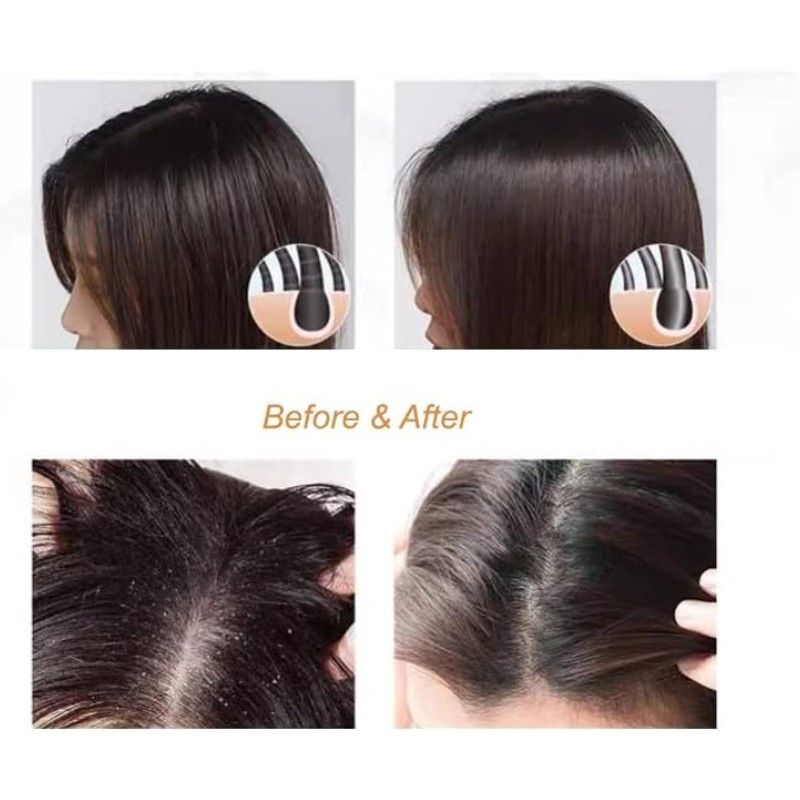 Spes Sea Salt Cream For Scalp Refreshing Anti-dandruff Shampoo 280g