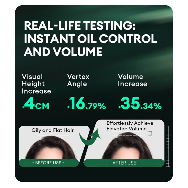 Spes Washing-free Hair Spray Dry Shampoo First Love 150ml