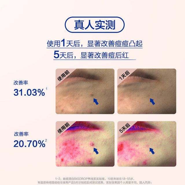 Big Drop 3 Point Acne Essence Barrier Repair Essence 10ml