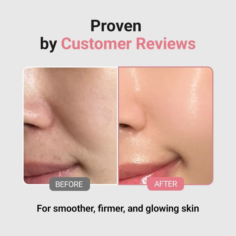 Sungboon Editor Deep Collagen Power Boosting Mask 4pcs