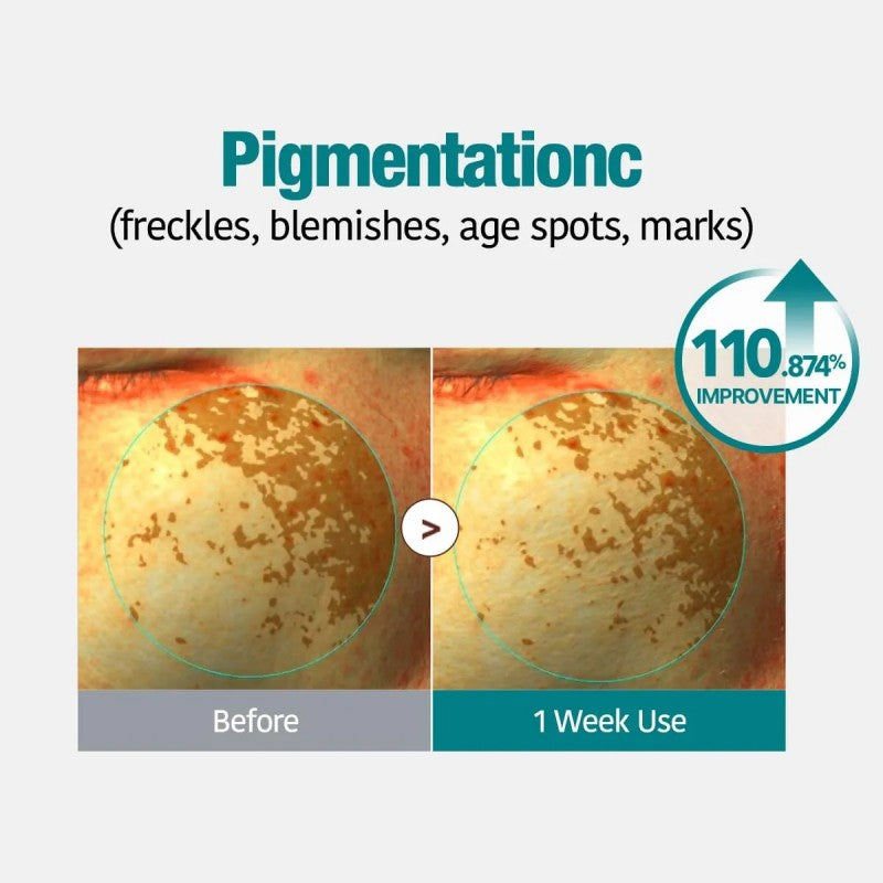 Goodal Green Tangerine Vita C Dark Spot Care Gel Mask 1pcs