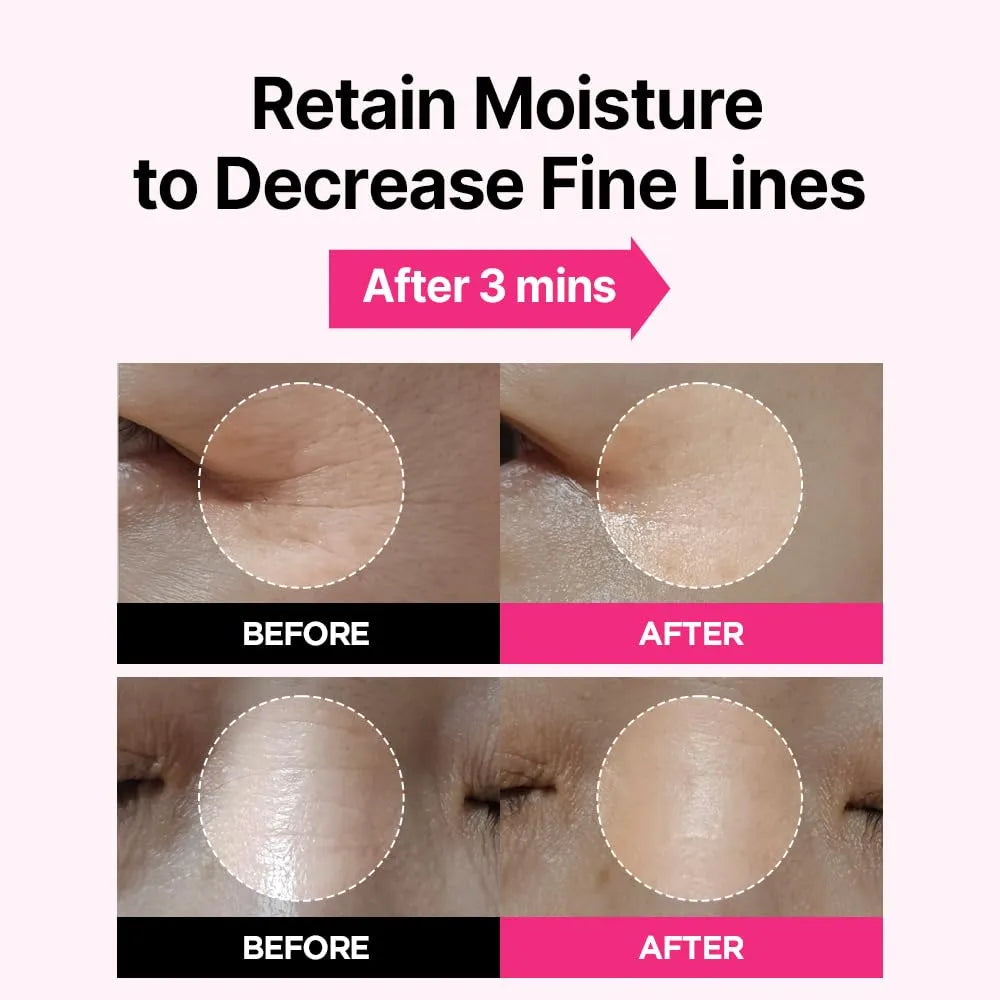 Isoi Blemish Care Eye & Wrinkle Patch Eye Mask 90+90pcs