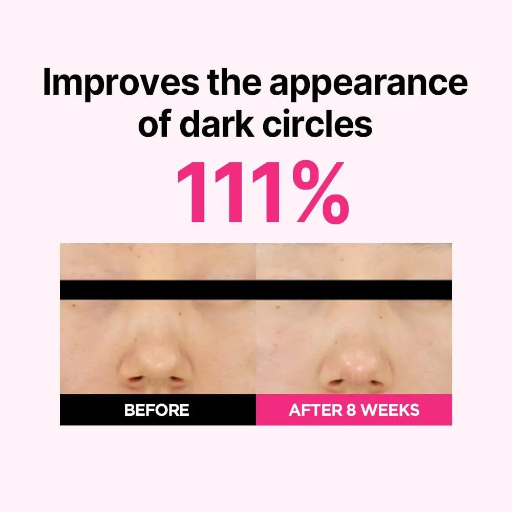 Isoi Blemish Care Eye & Wrinkle Patch Eye Mask 90+90pcs