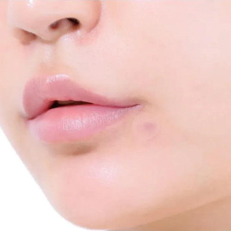 Olive Young欧利芙洋隐形痘痘贴祛痘积雪草舒缓 96贴