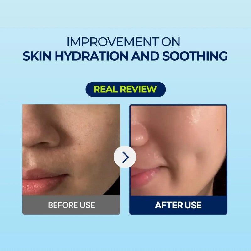 Torriden DIVE IN Low Molecular Hyaluronic Acid Mask 10pcs