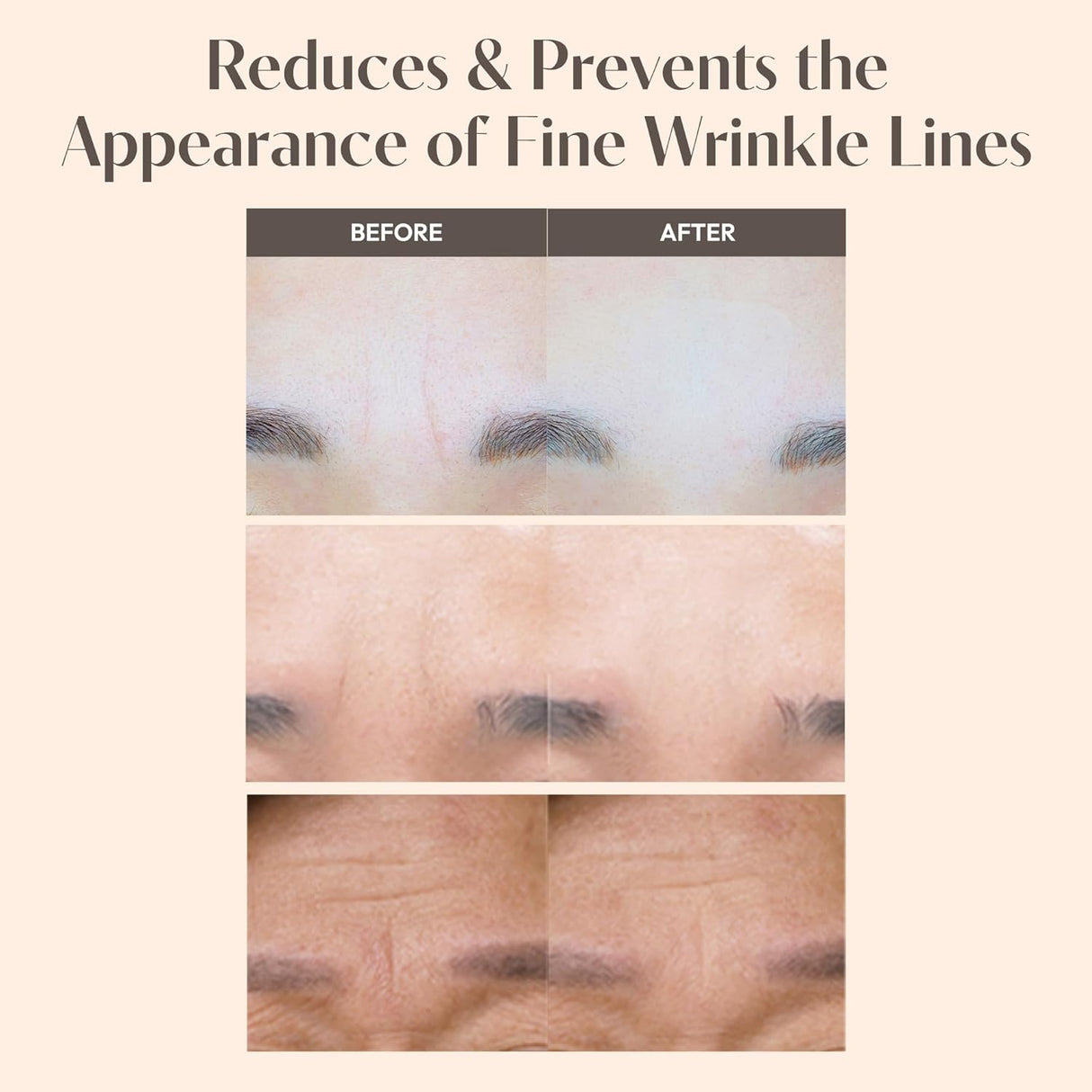 Marshique Wrinkle Repair Patch For Between Brows 33pcs +Multi Patch 12pcs
