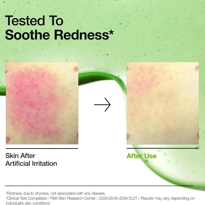 Anua Azelaic Acid 10 Hyaluron Redness Soothing Serum 30ml