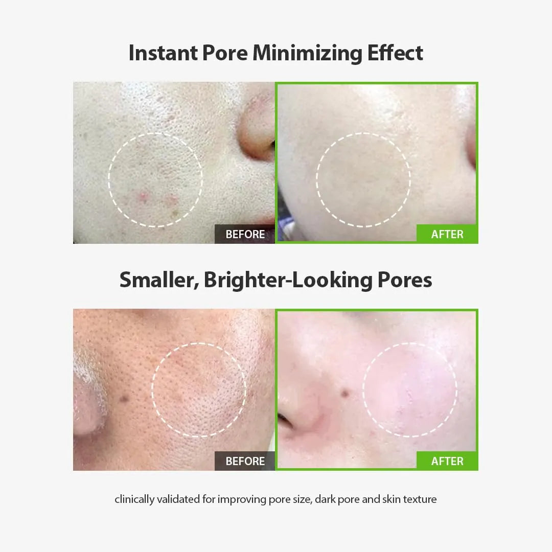 Sungboon Editor Green Tomato Pore Lifting Ampoule 30ml*2