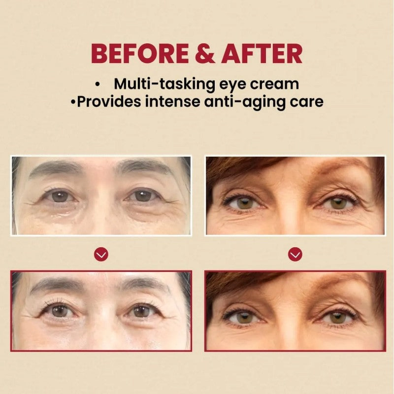 Ksecret Seoul 1988 Eye Cream Retinal Liposome 4% + Fermented Bean 30ml