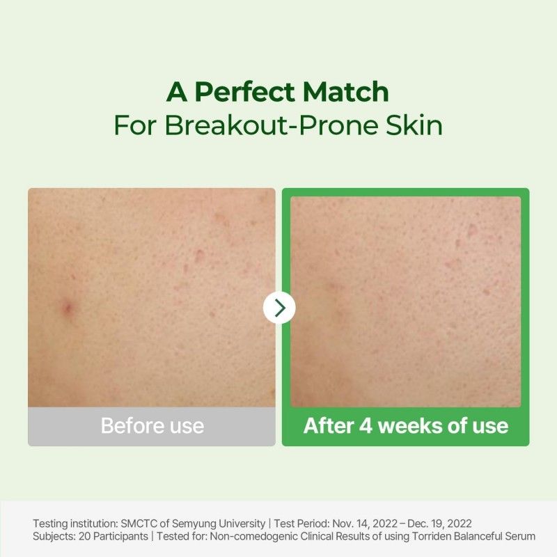 Torriden Balanceful Cica Calming Serum 50ml