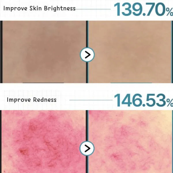 Mediheal Madecassoside Moisture Sun Serum Blemish Repair SPF50+ Kbo Hodori 50g