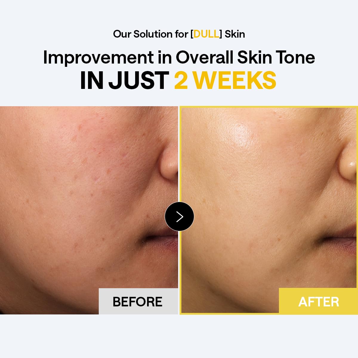 Mediheal Vitamin C Bright Toning Pad 100pcs