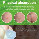 Acne Patche Random Styles 1pcs