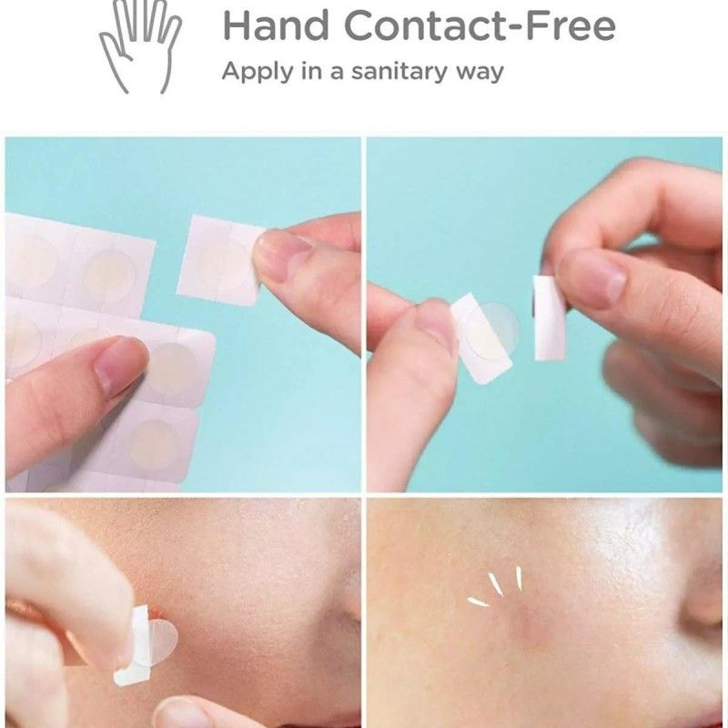 Derma Angel Acne Patches Day-Use 12+3pcs