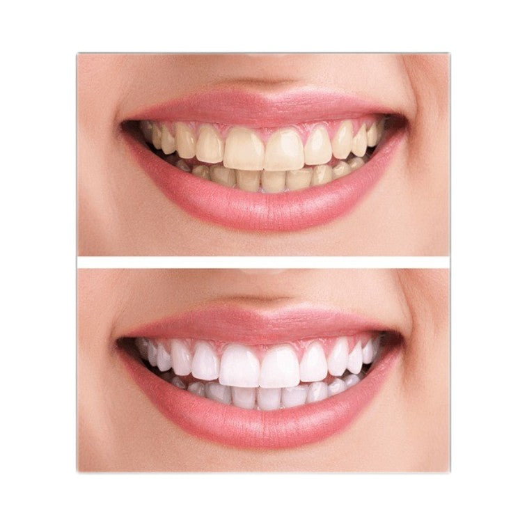 BOP Advanced Teeth Brightening Strips Sakura 14pcs