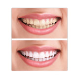 BOP Advanced Teeth Brightening Strips Sakura 14pcs