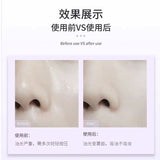AKF面部吸油纸 100片