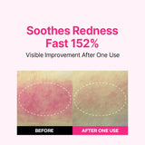 Isoi Bulgarian Rose Blemish Care Up Serum 20ml+20ml