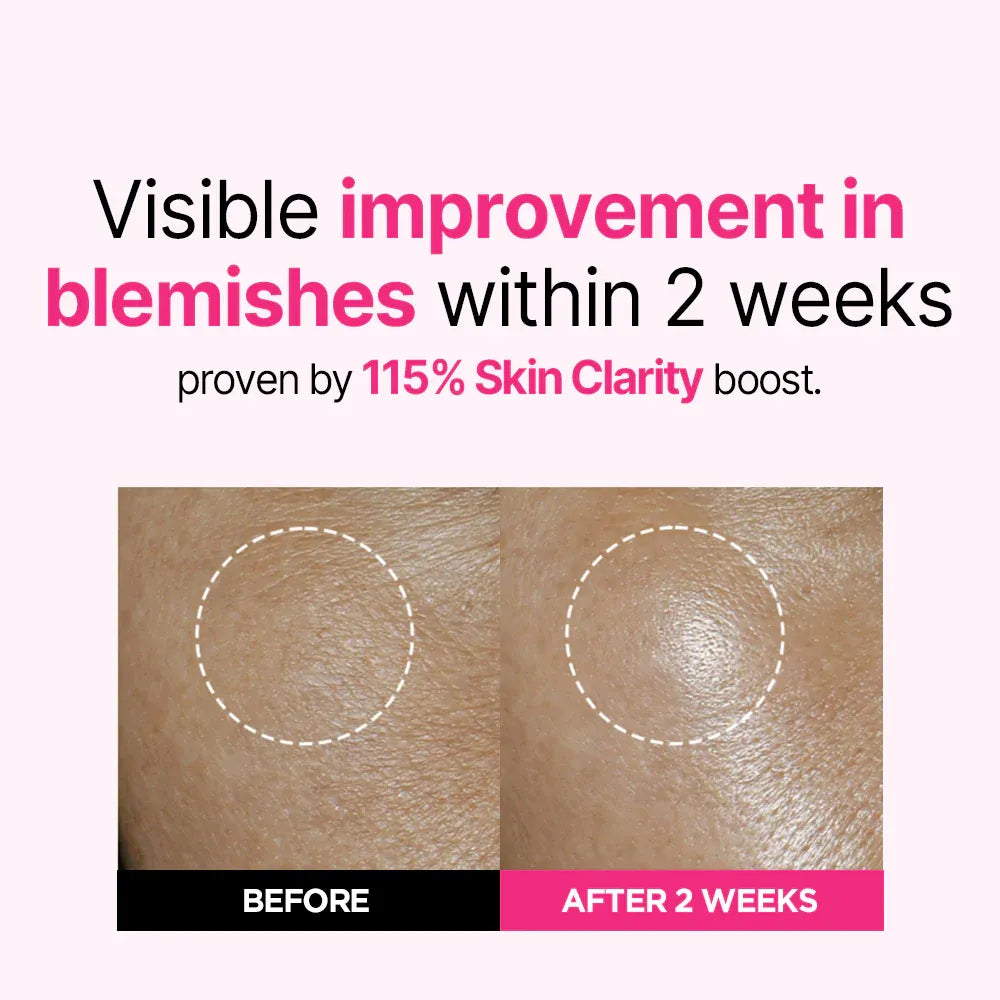 Isoi Bulgarian Rose Blemish Care Up Serum 20ml+20ml