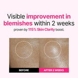 Isoi Bulgarian Rose Blemish Care Up Serum 20ml+20ml