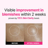 Isoi Bulgarian Rose Blemish Care Up Serum 20ml+20ml