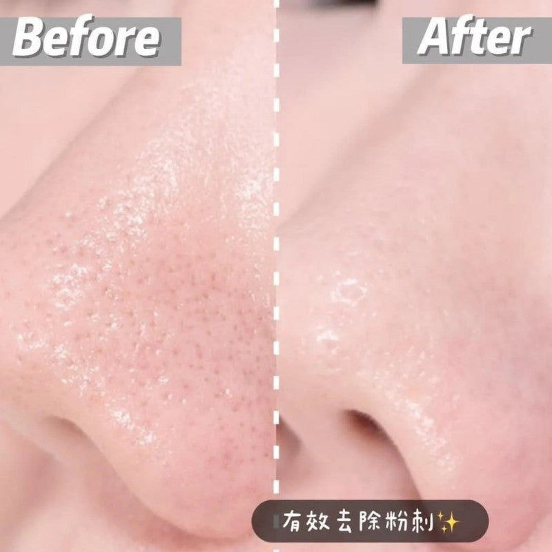 Dong-A Pharm Comedonal Aclean Gel 20g