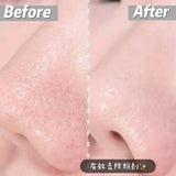 Dong-A Pharm Comedonal Aclean Gel 20g
