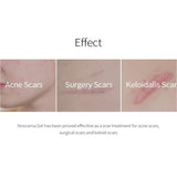 Donga Pharm Noscarna Acne Scars Removal Gel 13g