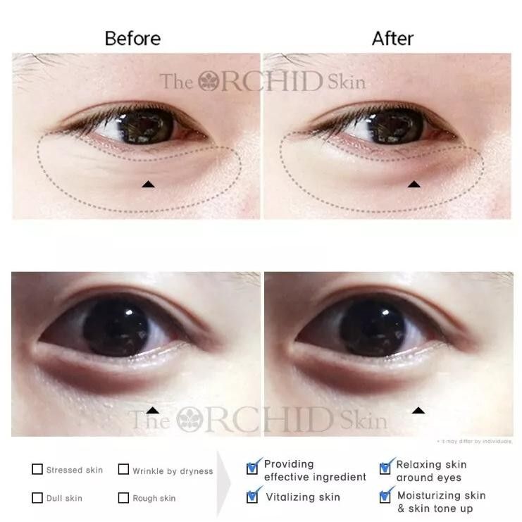 The Orchid Skin Elastic Under Youth Eye Patch 10 pairs