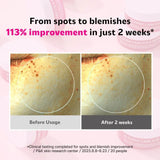 Isoi Blemish Care Eye & Wrinkle Patch 90pcs