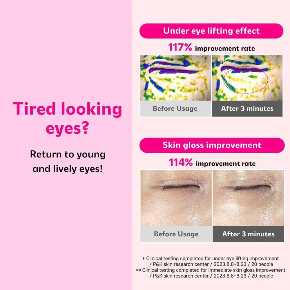 Isoi Blemish Care Eye & Wrinkle Patch 90pcs