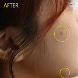 Olive Young Care Plus Glutathione Blemish Patch Clear Acne 12pcs