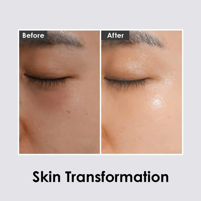 Medi Peel美蒂菲透明质酸去黑提亮眼膜 60枚