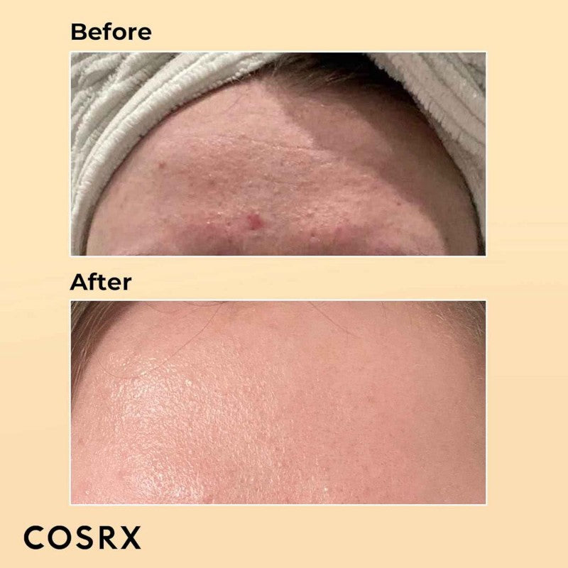 Cosrx Advanced Snail 96 Mucin Power Essence 100 ml