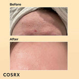 Cosrx Advanced Snail 96 Mucin Power Essence 100 ml