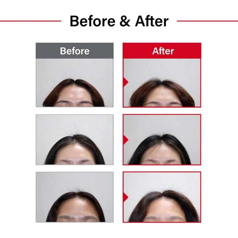 Dr.Forhair Folligen Shampoo 300ml*2