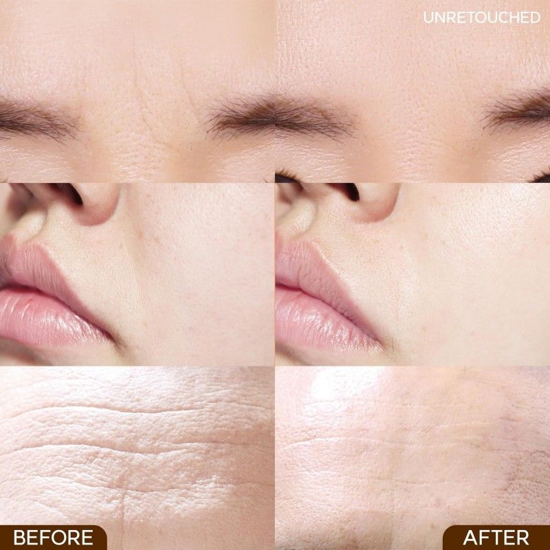 Olive Young Marshique额头细纹贴抗皱消纹 15枚