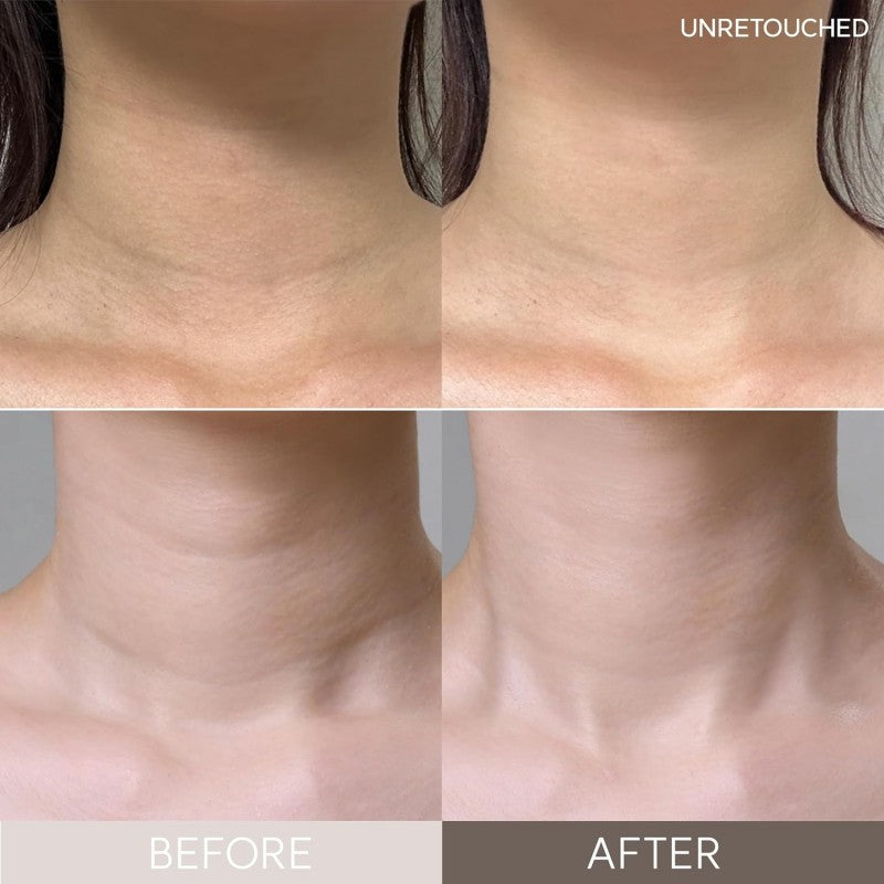 Marshique Wrinkle Repair Hydrogel Neck Patch 4pcs