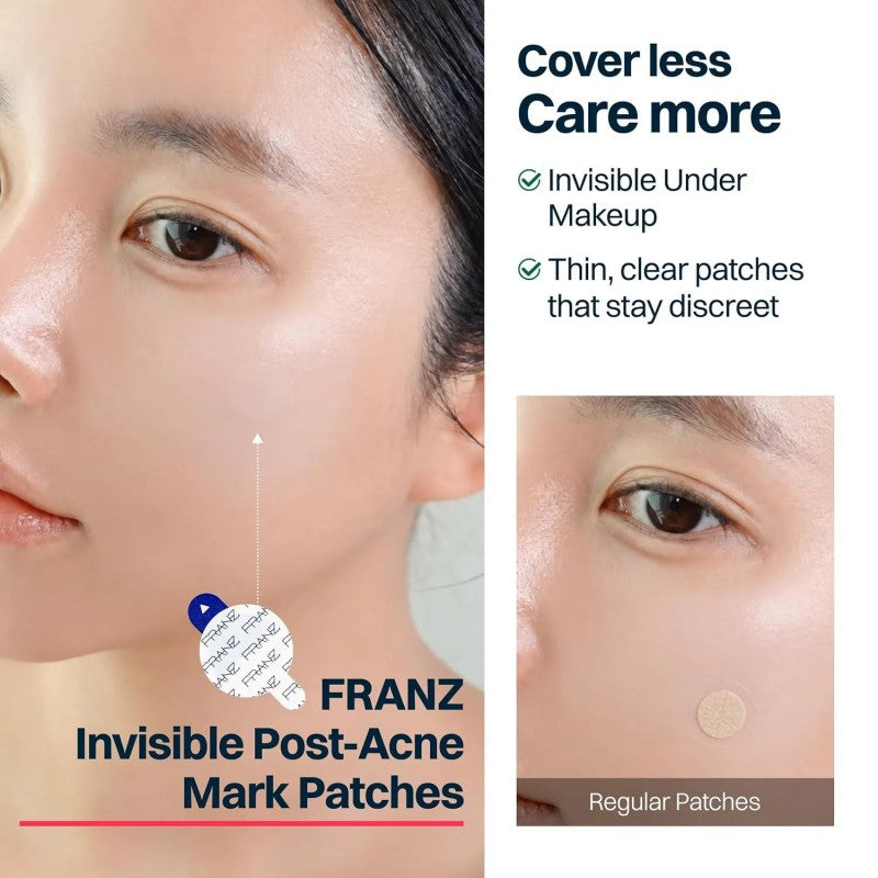Franz Early Spot Naked Early Spot Patch 72pcs