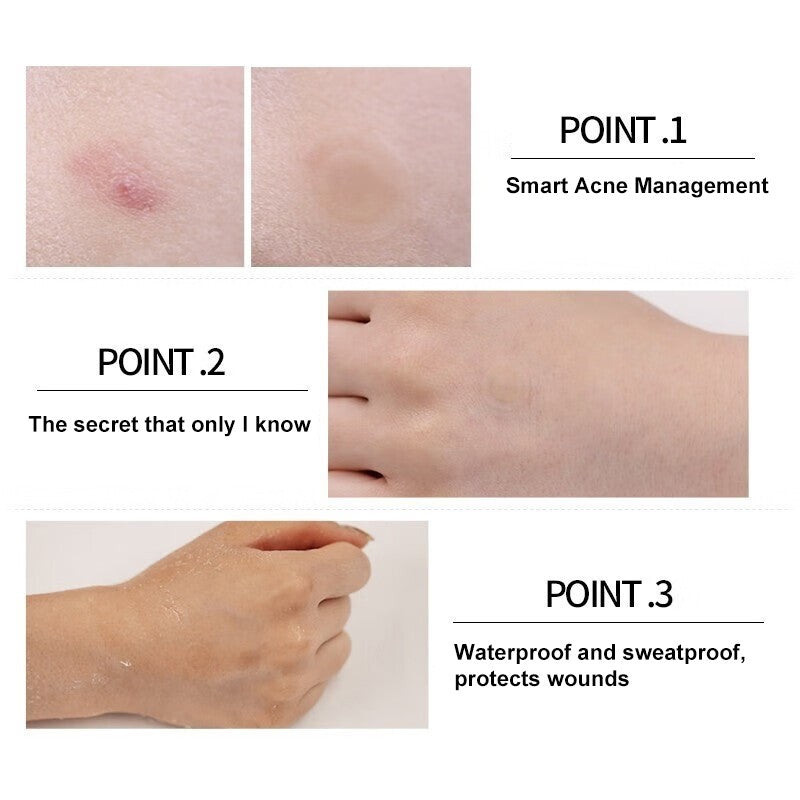 VT Cosmetics Cica Care Spot Patch Acne Relief 48pcs