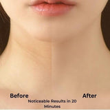 Kiss Muses亲吻缪斯颈膜抗皱紧致淡纹颈纹贴 10片