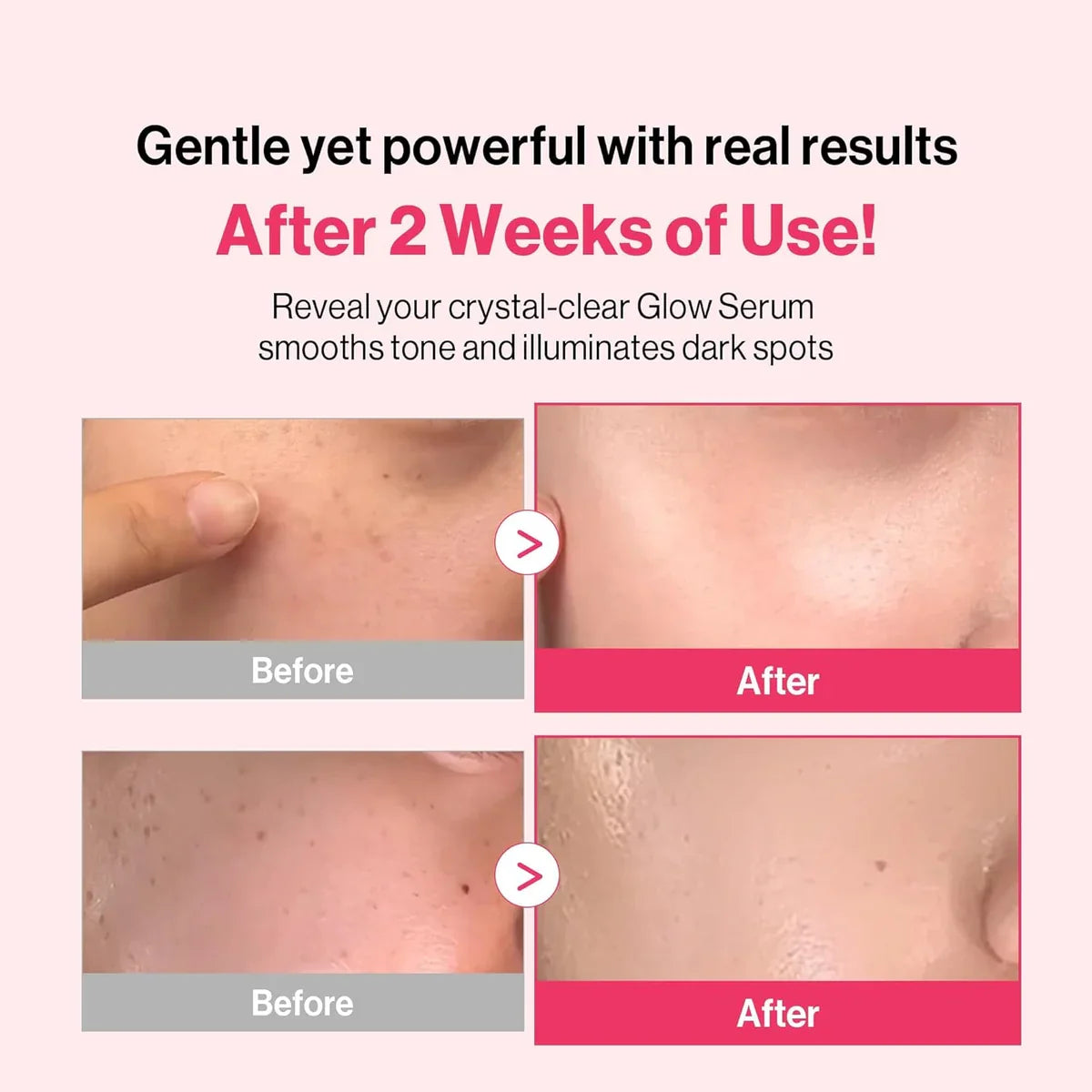 Re:dence Tone & Spot Perfect Glow Mask 1pcs